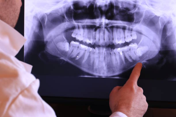 Best Emergency Root Canal Treatment in Weatherford, TX