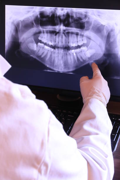 Best Emergency Dental Care for Broken or Chipped Teeth in Weatherford, TX